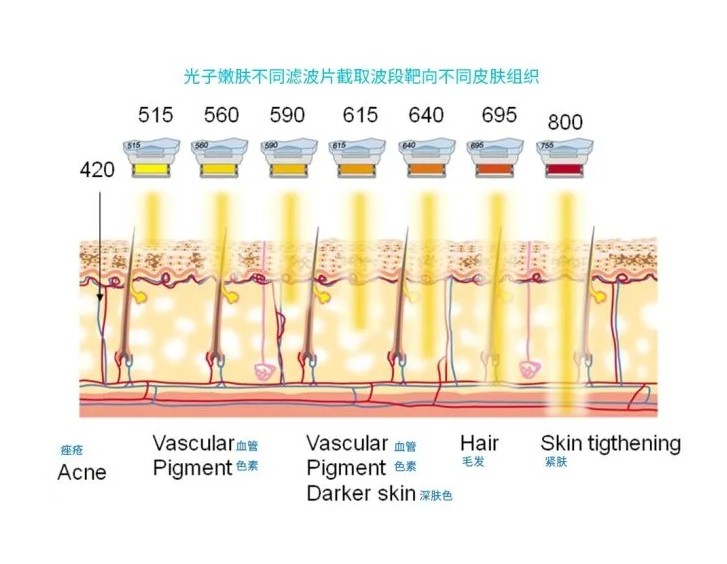 五大光子嫩膚技術(shù)（IPL、DPL、OPT、APT、BBL）及濾光片區(qū)別