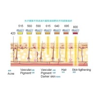 五大光子嫩膚技術(shù)（IPL、DPL、OPT、APT、BBL）及濾光片區(qū)別